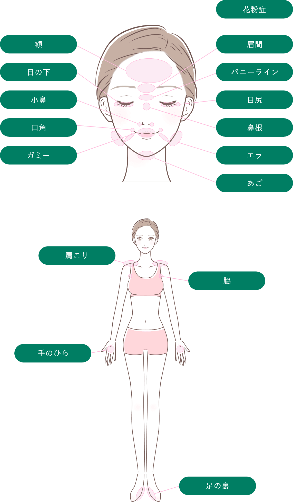ボトックスの対応部位
