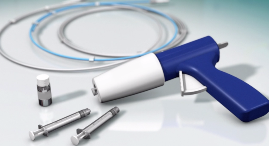 【静脈瘤の治療紹介！　グルー治療編・動画あり】