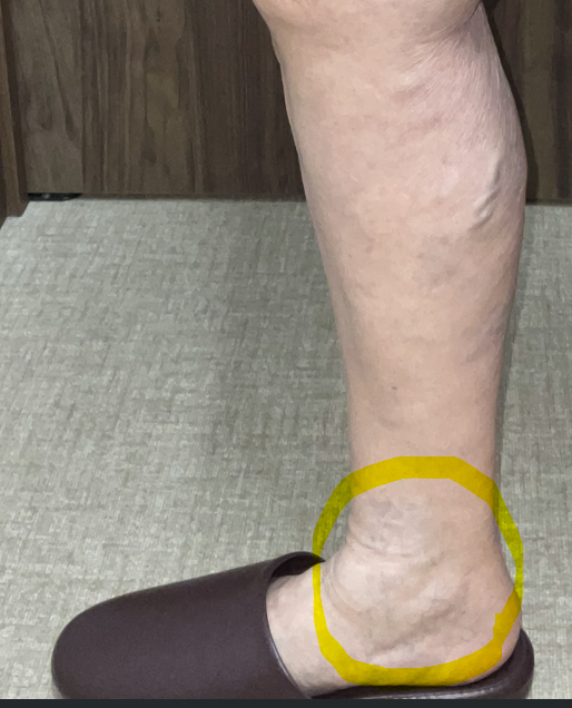 細絡（さいらく）は治療すべき？